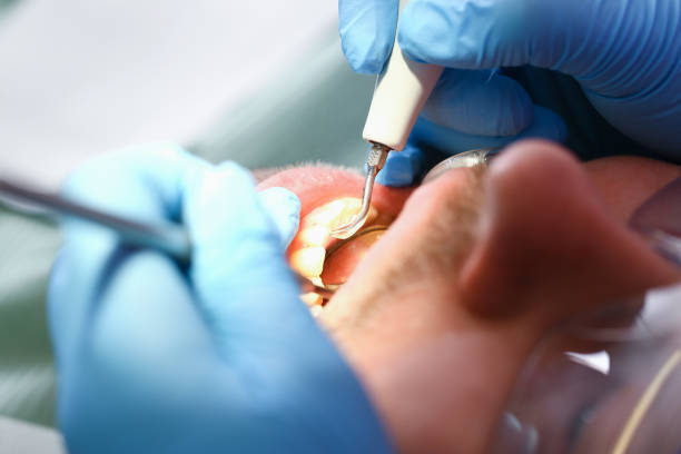 Urgent Tooth Repair in KS