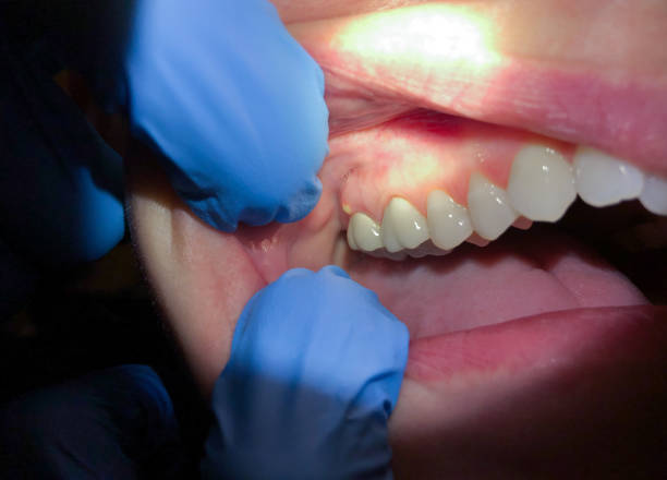 Best Tooth Pain Emergency Relief  in Wellington, KS