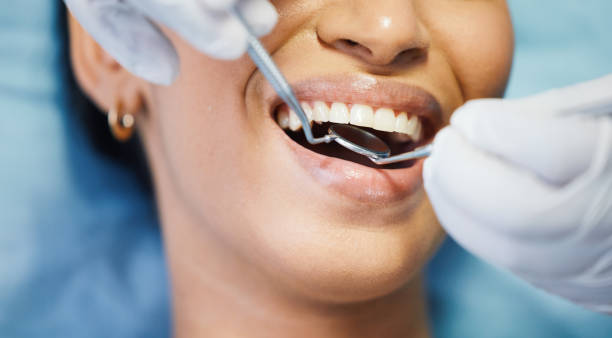 Best Teeth Whitening  in Wellington, KS