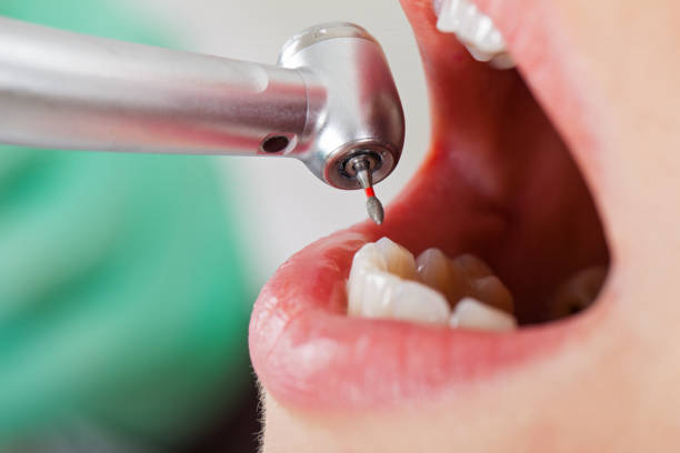 Best Root Canal Emergency Dentist  in Wellington, KS